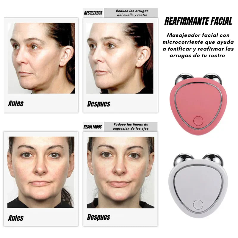 Masajeador Facial de Microcorriente - Rostro Más Firme, Más Joven