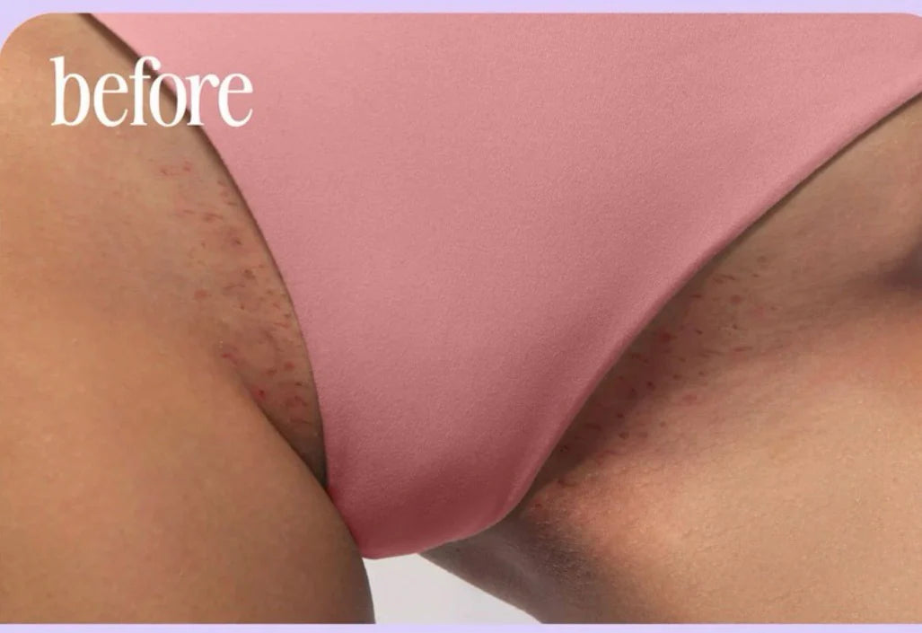 Combo Truly – Sérum