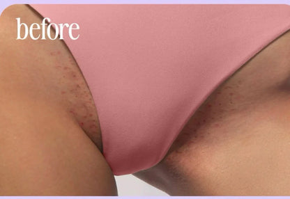 Combo Truly – Sérum